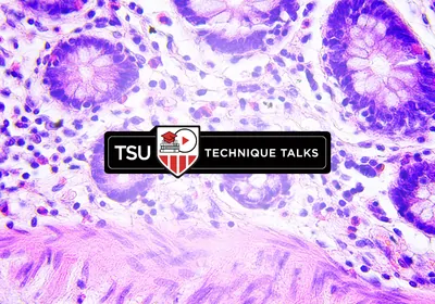 Technique Talk: Developing and Optimizing Immunohistochemistry Protocols Technique Talk: Developing and Optimizing Immunohistochemistry Protocols